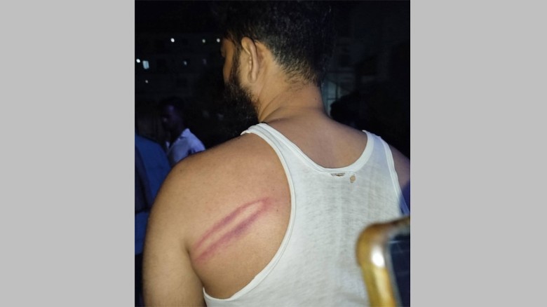 গাজীপুরে দুর্বৃত্তদের হামলায় জামায়াতের ১০ নেতাকর্ম...